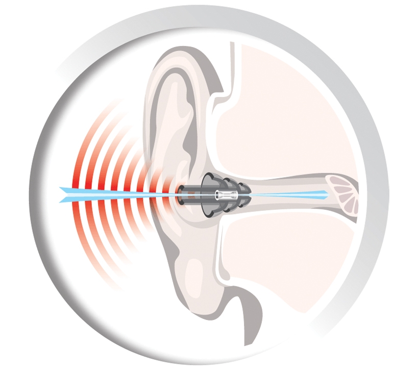 Auritech Shoot Hearing Protector Ear Plugs