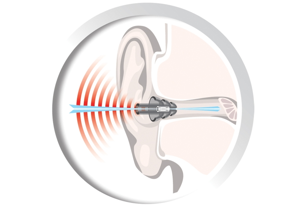 Auritech Shoot Hearing Protector Ear Plugs